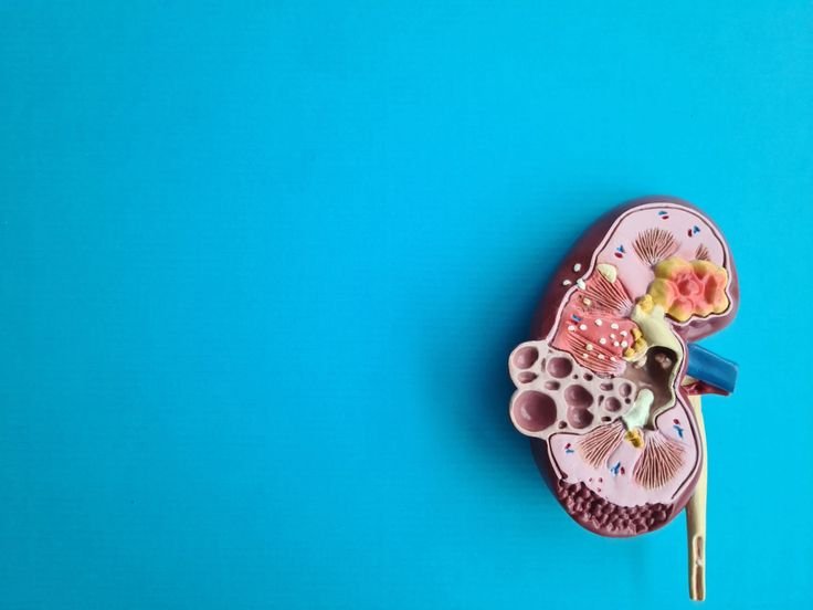 Νεφρολιθίαση