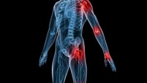 Προστασία αρθρώσεων: καθημερινές συνήθειες που βοηθούν