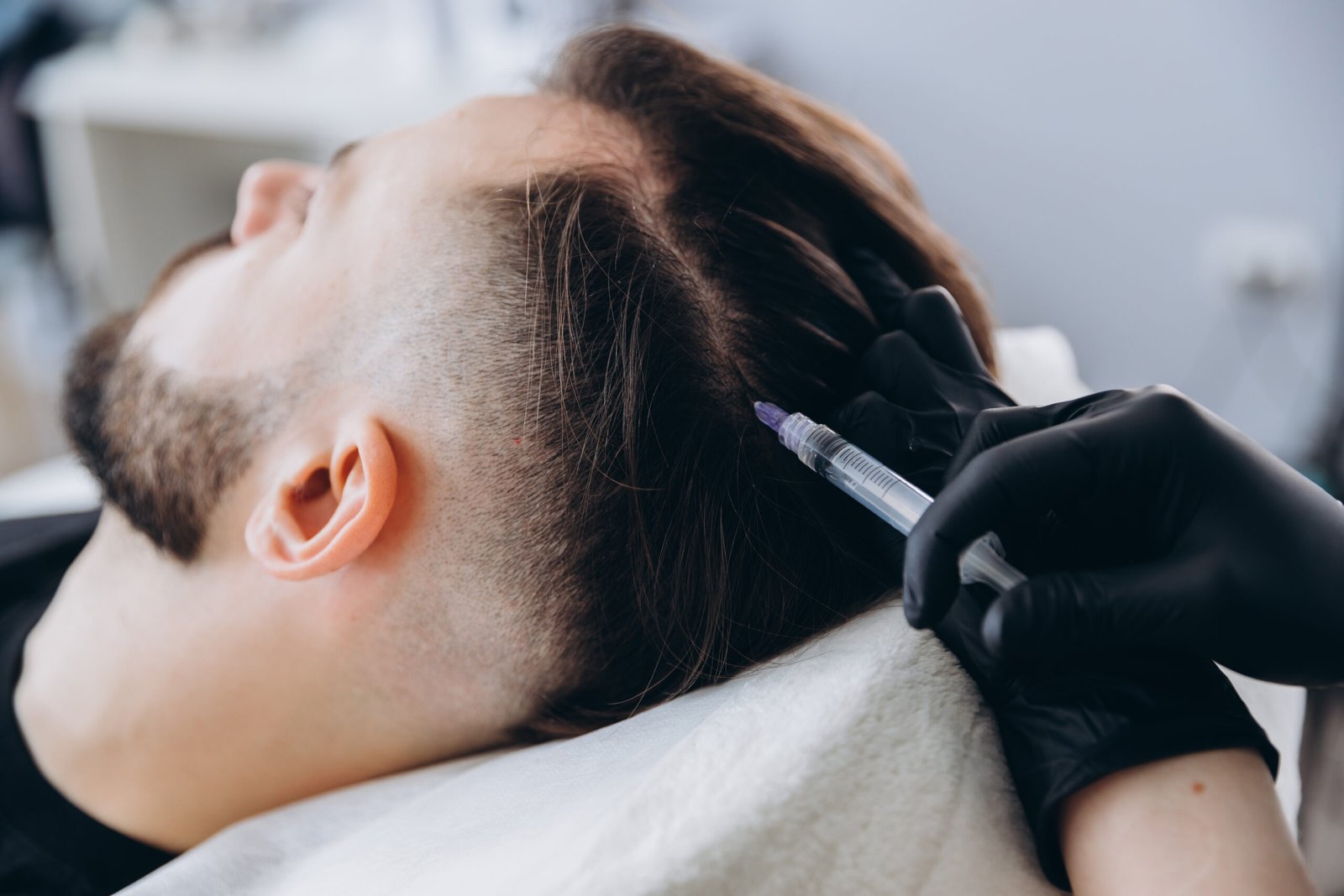 Ψυχολογία πριν και μετά τη μεταμόσχευση μαλλιών: τι βιώνει ο ασθενής