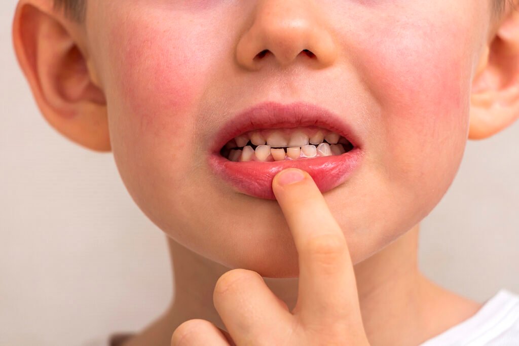 Διάγνωση τριχόπτωσης: Γιατί η σωστή αξιολόγηση καθορίζει το τελικό αποτέλεσμα