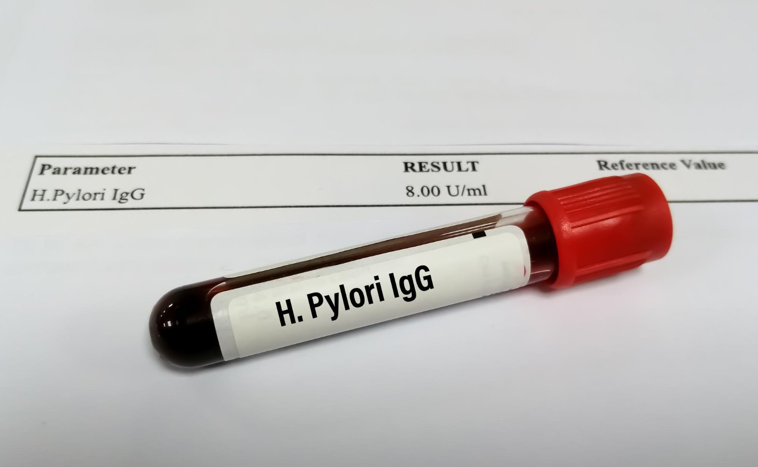 H. pylori test